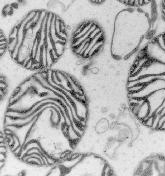 Die Mikroskop-Aufnahme zeigt Mitochondrien, die auch als Kraftwerke der Zellen bekannt sind. (Foto: AG Herrmann)