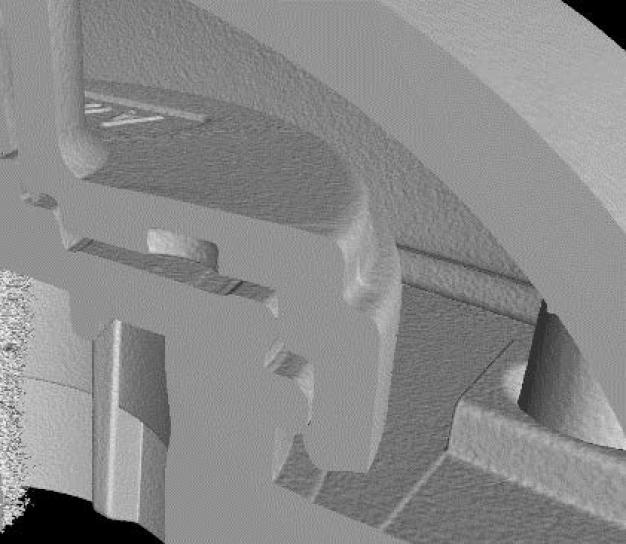 Ein CT des Drug Delivery Device zeigt den für den Druckverlust verantwortlichen Bereich. / A CT of the drug delivery device shows the section responsible for the pressure loss.