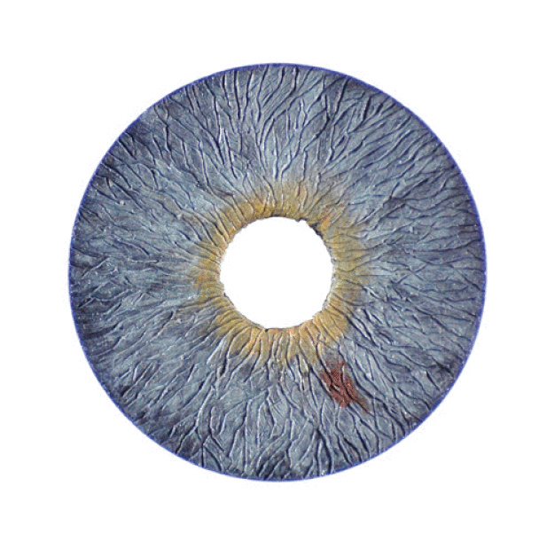 Abb. 4: Die künstlichen Augenlinsen der HumanOptics AG werden unter strengen Vorgaben des Qualitätsmanagementsystems produziert.