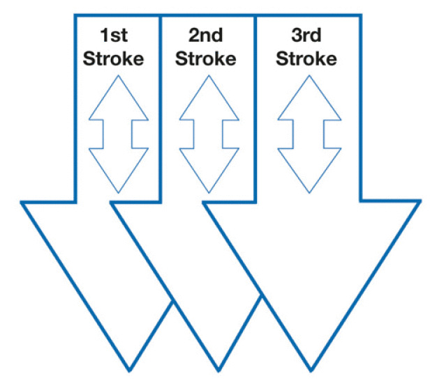 Illustration 1: “Pull-Lift” technique with agitation
