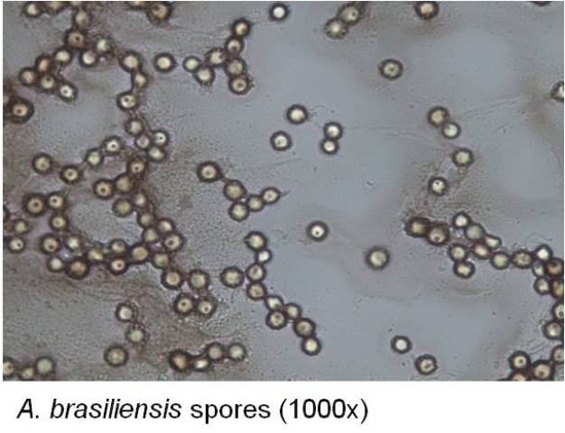 A. brasiliensis-Sporen (1000fach) / A. brasiliensis spores (1000x