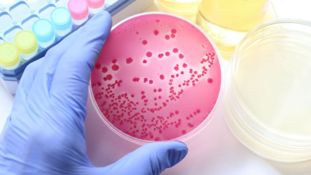 Aspergillus carbonarius DSM 872 künftig bevorzugter Testkeim für die Überprüfung der Entkeimungsleistung von UV-basierten Entkeimungsverfahren. (shutterstock) /  Aspergillus carbonarius DSM 872 to become preferred test germ for checking the sterilization performance of UV-based sterilization processes. (shutterstock)