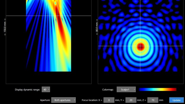 In der Therapieplanung werden die Schallfelder für eine bestimmte Region im Gehirn berechnet und festgelegt. © Fraunhofer IBMT / In therapy planning, the sound fields are calculated and defined for a specific region of the brain. © Fraunhofer IBMT