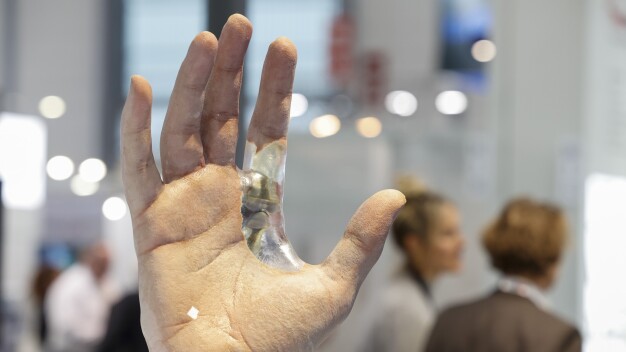 Unscheinbar und doch hochinnotiv - Implantate sind Hightechprodukte (© Constanze Tillmann). / Inconspicuous and yet highly innovative - implants are high-tech products (© Constanze Tillmann). 