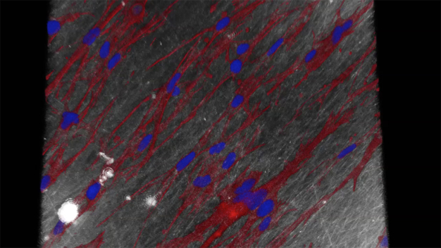 Fibroblasten (Bindegewebszellen) auf der elektroversponnenen Renacer®-Membran unter dem Konfokalmikroskop (rot: Zytoskelett der Zellen, blau: Zellkerne) © Fraunhofer ITEM / Fibroblasts (connec-tive tissue cells) on the electrospun Renacer® membrane under the confocal micro-scope (red: cytoskeleton of the cells, blue: cell nuclei). © Fraunhofer ITEM