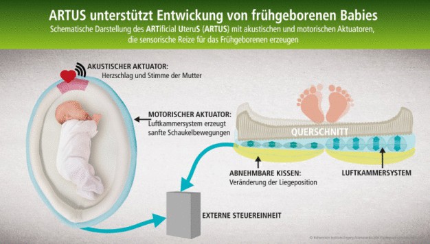 Schematische Darstellung der Funktionsweise der künstlichen Gebärmutter „ARTUS“. Die Entwicklung wurde 2015 in der Kategorie „NewApplication“ mit dem „Techtextil Innovation Award“ ausgezeichnet. (© Hohenstein Group) / Diagram showing how the artificial uterus