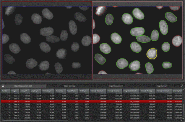 Leica Application Suite Advanced Fluorescence (LAS AF) 4.0 ist die Softwareplattform für anspruchsvolle biomedizinische Forschung mit Weitfeld- und Konfokalmikroskopie. Die Abbildung zeigt das 2D-Analyse Modul bei der automatischen Zellkernzählung. / Leica Application Suite Advanced Fluorescence (LAS AF) 4.0 is the software platform for advanced life science research in widefield and confocal microscopy. The image shows the 2D Analysis Module used to count nuclei automatically.