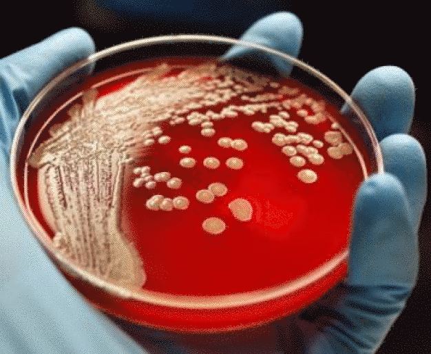 MRSA Colonien