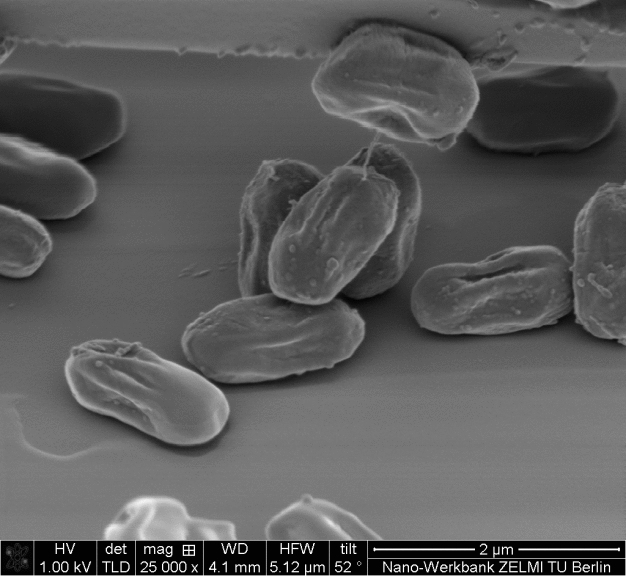 Sporenzellen unter dem Raster-ELektronenmikroskop
(© TU Berlin/ZELMI)