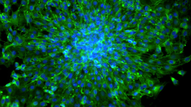 Aktin gefärbter 3T3 Fibroblastensphäroid für den LIFT-Transfer, kultiviert in lasergefertigten Mikronäpfchen. © Fraunhofer ILT, Aachen / Actin stained 3T3 fibroblast spheroid for LIFT transfer cultured in laser fabricated micro wells. © Fraunhofer ILT, Aachen, Germany