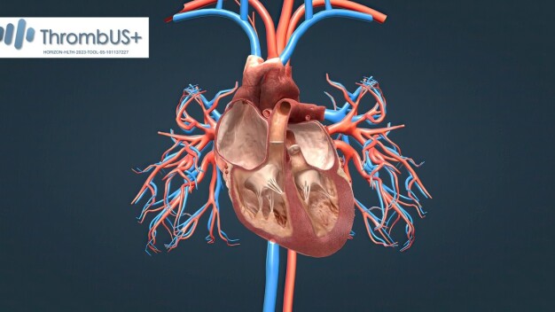 Darstellung einer Lungenembolie, einer potenziell tödlichen Komplikation durch einen Venenthrombose. © Fraunhofer IPMS / Illustration of a pulmonary embolism, a potentially fatal complication caused by a venous thrombosis. © Fraunhofer IPMS
